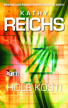 Holé kosti